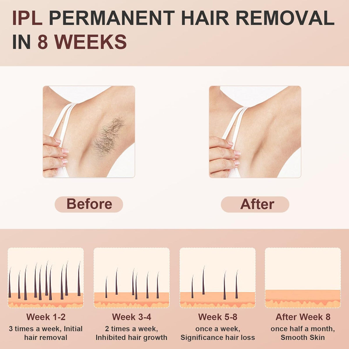 999900 Flashes IPL Hair Removal Device with Cooling System Y9437